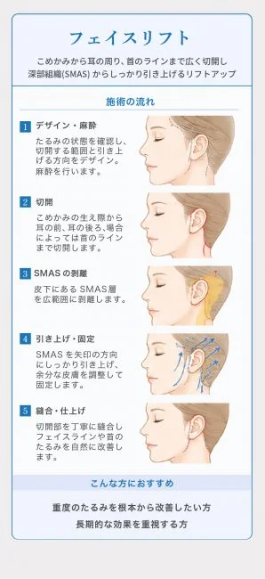 【期間限定】 ミニフェイスリフトキャンペーン
