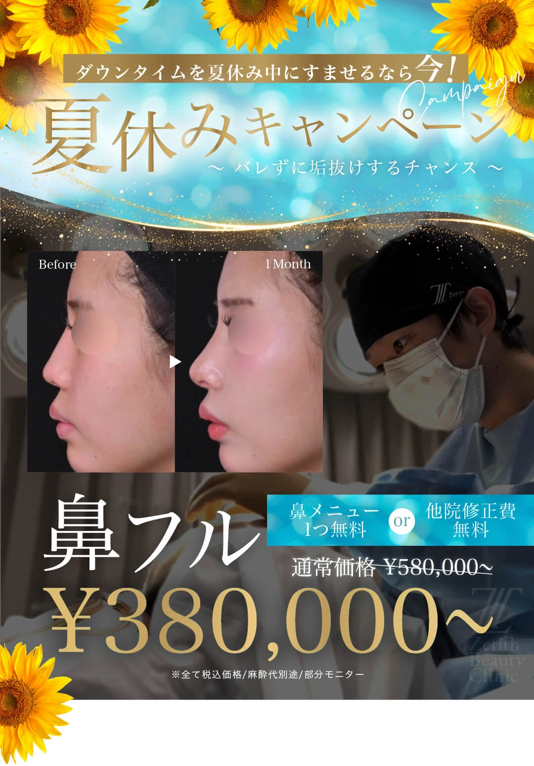 Limited to Dr. Hane: 2026 Nose Fixed-Price Plan Summer Gift Campaign