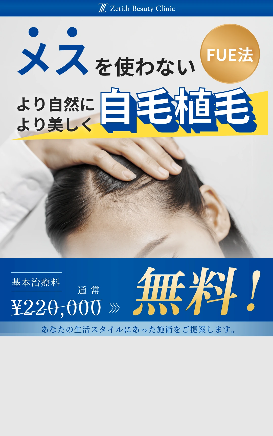 【木塚医師限定】 植毛キャンペーン
