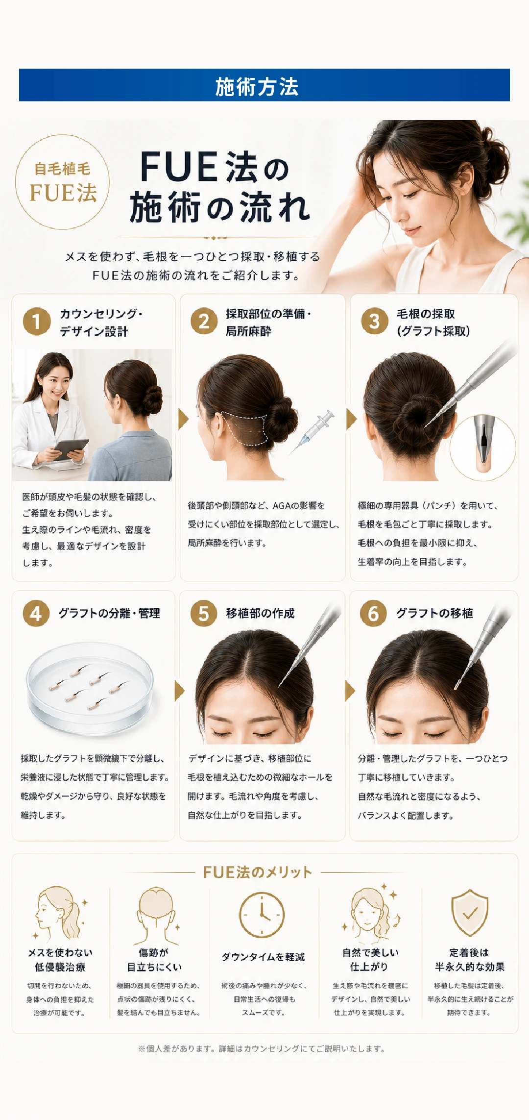 【木塚医師限定】 植毛キャンペーン