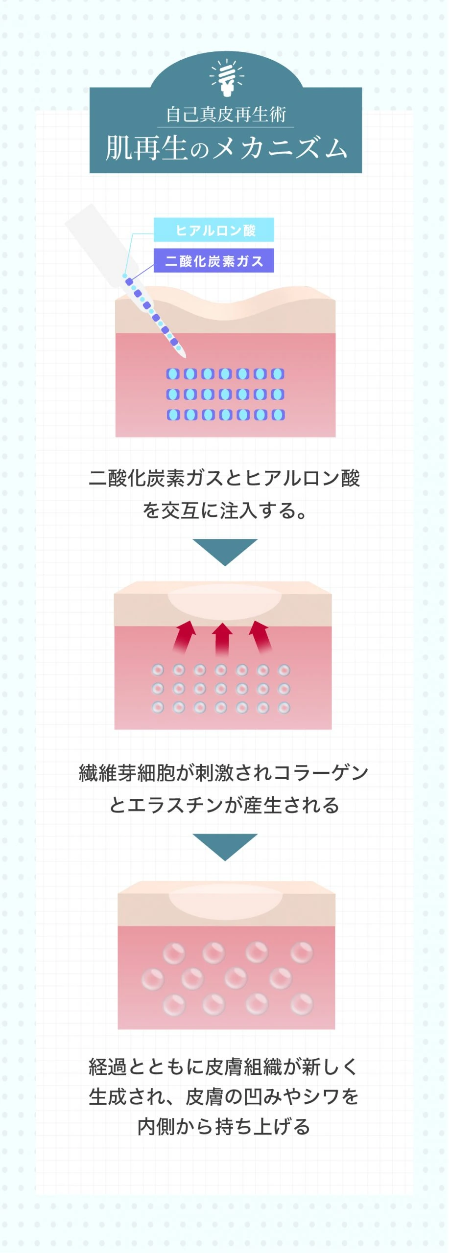 ジュブゼン 新宿院キャンペーン