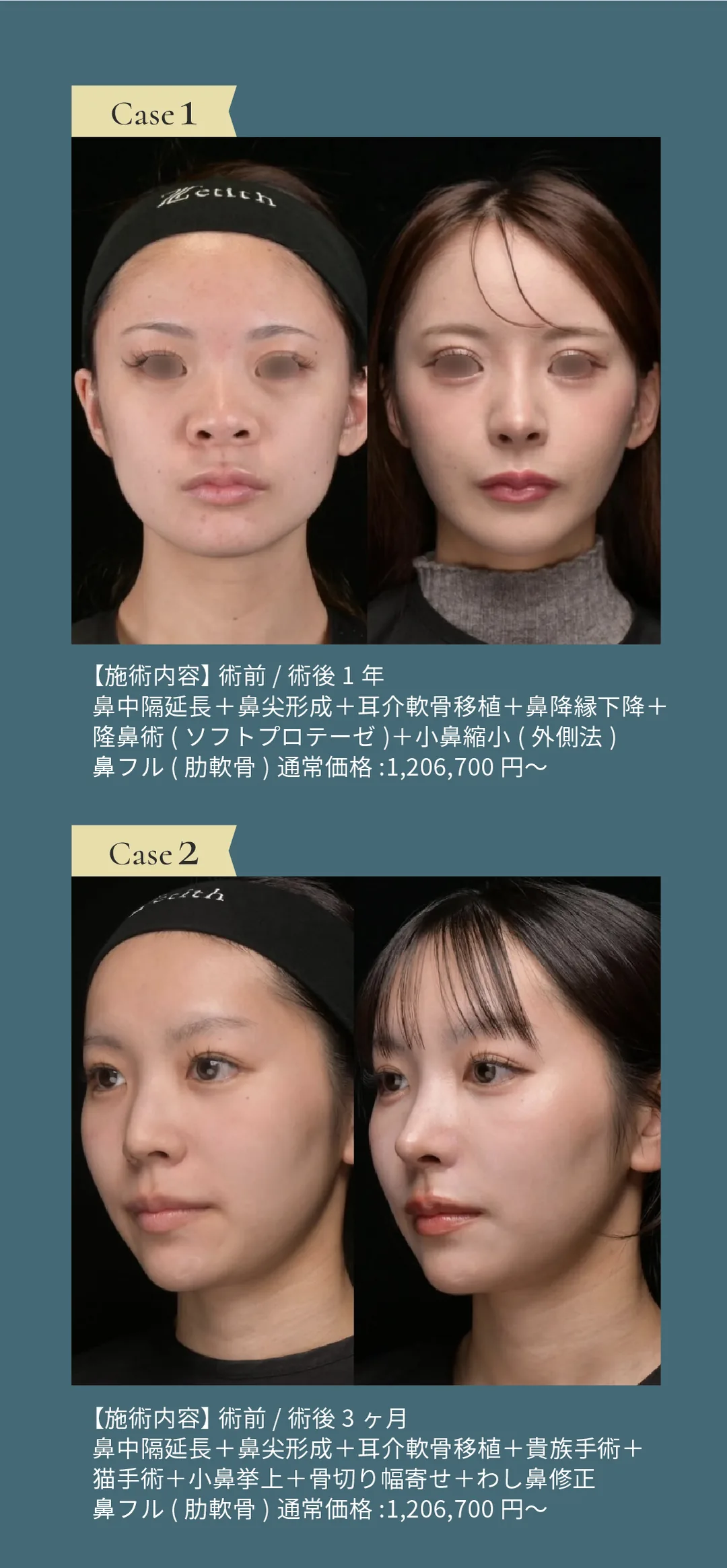 【鼻のスペシャリスト】 鉄医師の鼻整形