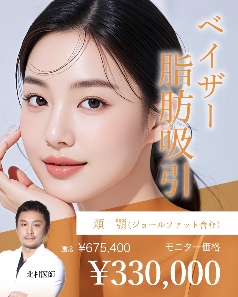 北村医師 小顔キャンペーン