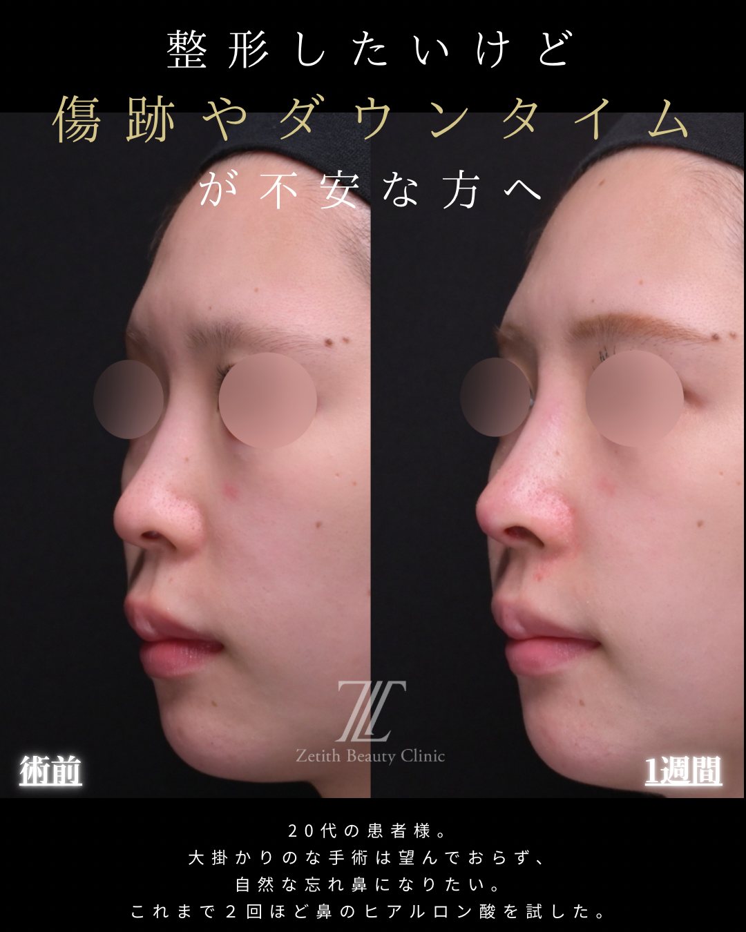 èªå®¶çµç¹é錻ãå«ãçäŸ æã è¡åã»è¡åŸ